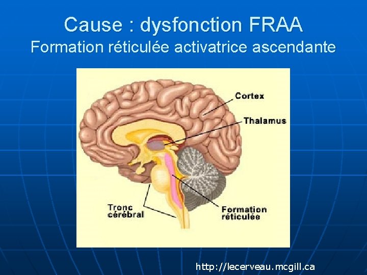 Cause : dysfonction FRAA Formation réticulée activatrice ascendante http: //lecerveau. mcgill. ca 