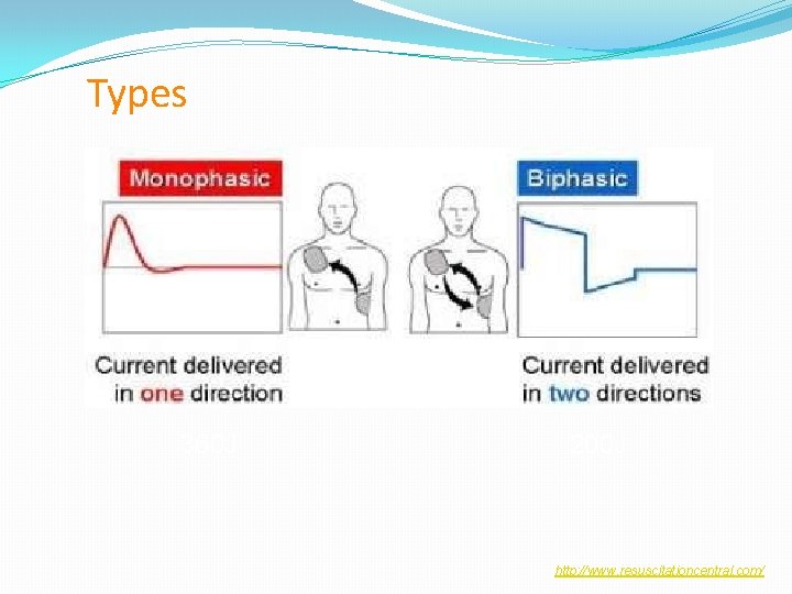 8 Types 360 J 200 J http: //www. resuscitationcentral. com/ 8 Types 360 J 200 J http: //www. resuscitationcentral. com/