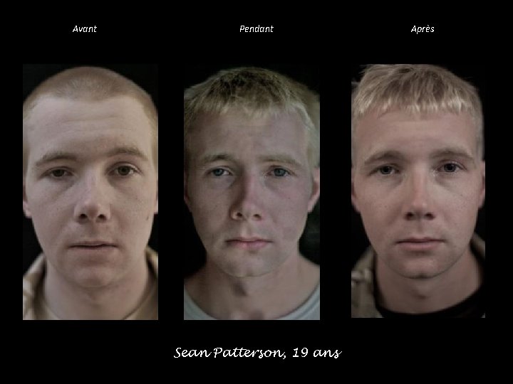 Avant Pendant Sean Patterson, 19 ans Après 