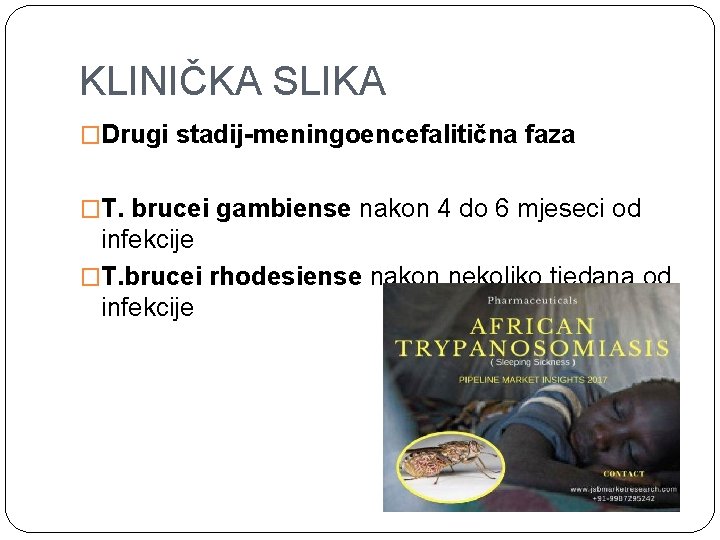 KLINIČKA SLIKA �Drugi stadij-meningoencefalitična faza �T. brucei gambiense nakon 4 do 6 mjeseci od