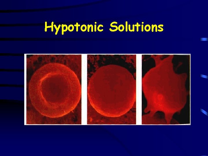 Hypotonic Solutions 