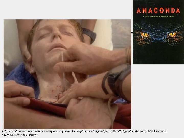 Actor Eric Stoltz receives a patent airway courtesy actor Jon Voight and a ballpoint