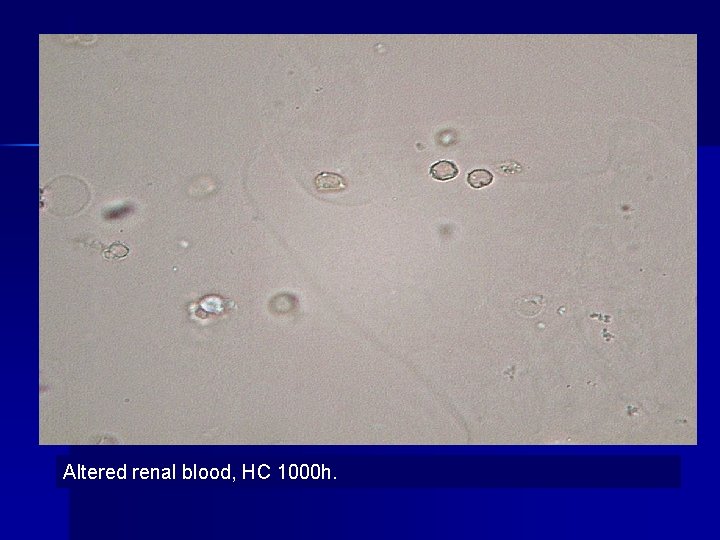 Altered renal blood, HC 1000 h. 