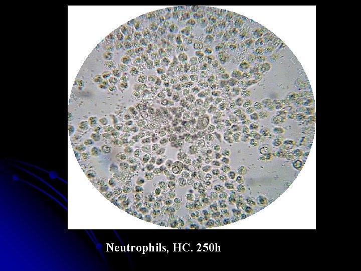 Neutrophils, HC. 250 h 