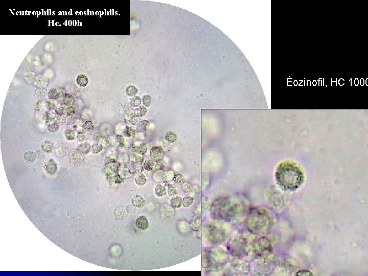 Neutrophils and eosinophils. Hc. 400 h Èozinofil, HC 1000 