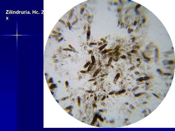 Zilindruria. Hc. 200 x 