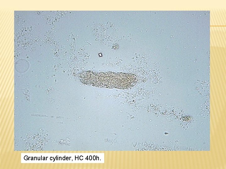 Granular cylinder, HC 400 h. 