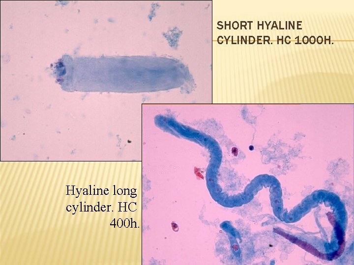SHORT HYALINE CYLINDER. HC 1000 H. Hyaline long cylinder. HC 400 h. 