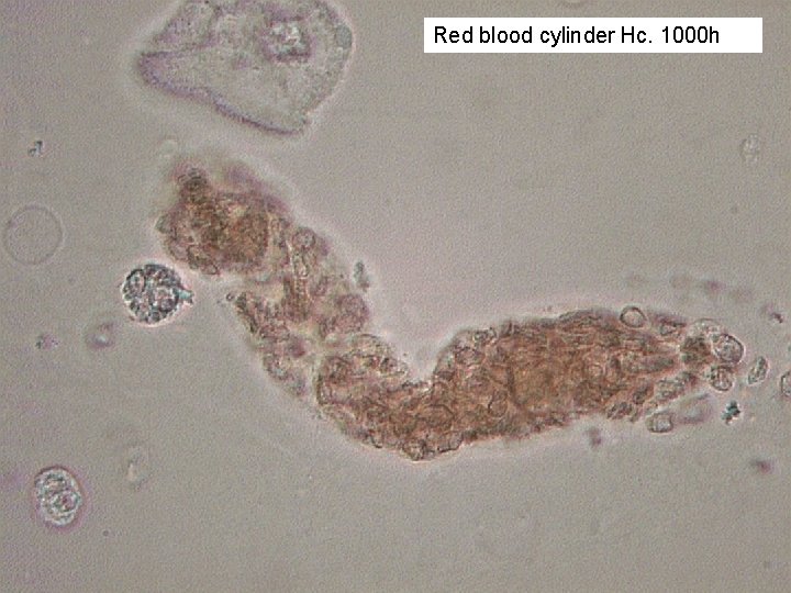 Red blood cylinder Hc. 1000 h 