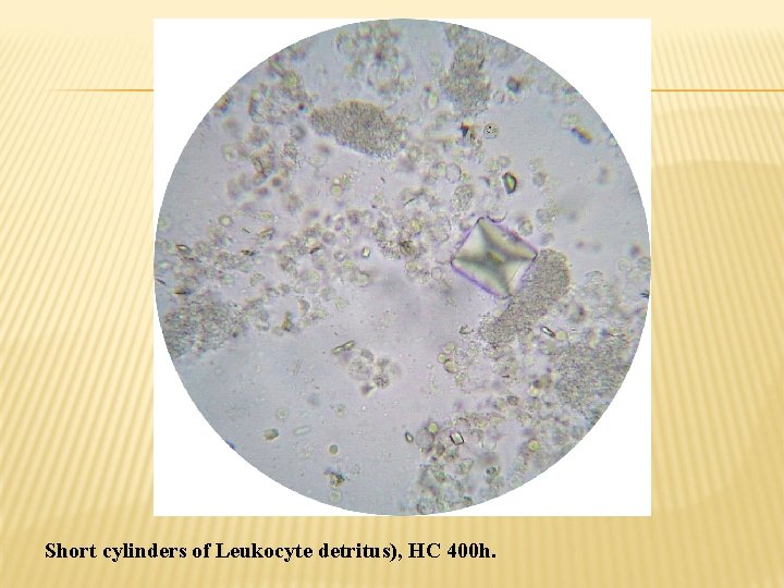 Short cylinders of Leukocyte detritus), HC 400 h. 