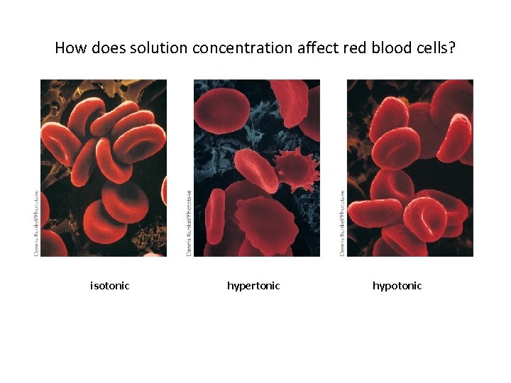 How does solution concentration affect red blood cells? isotonic hypertonic hypotonic 