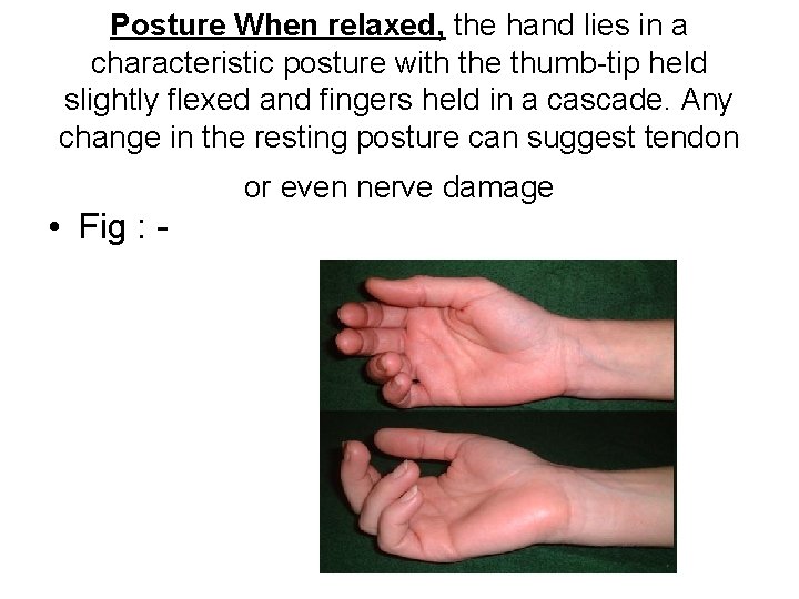 Posture When relaxed, the hand lies in a characteristic posture with the thumb-tip held