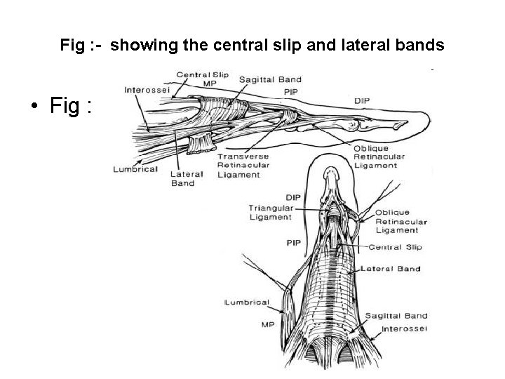 Fig : - showing the central slip and lateral bands • Fig : 