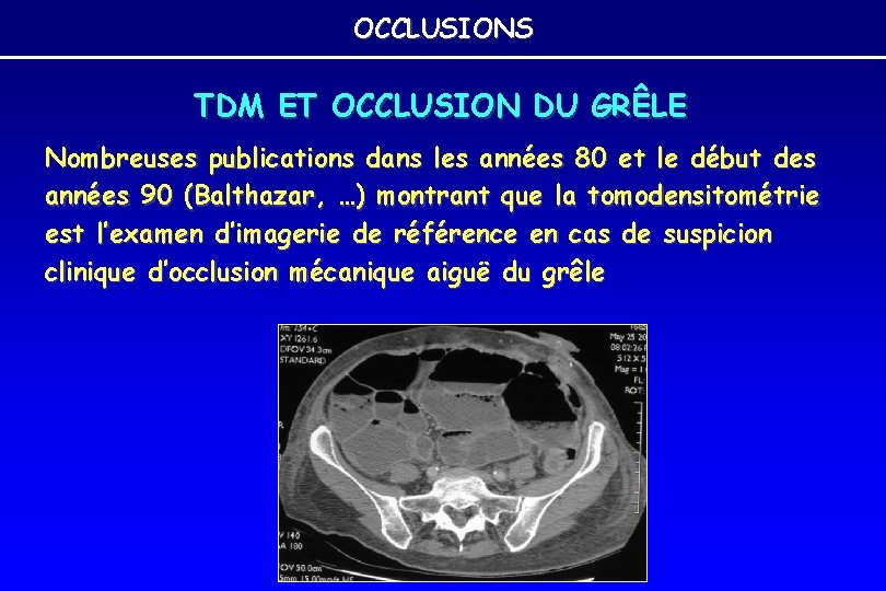 OCCLUSIONS TDM ET OCCLUSION DU GRÊLE Nombreuses publications dans les années 80 et le OCCLUSIONS TDM ET OCCLUSION DU GRÊLE Nombreuses publications dans les années 80 et le