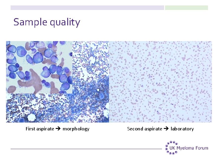 Sample quality First aspirate morphology Second aspirate laboratory 