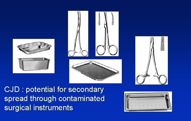 CJD : potential for secondary spread through contaminated surgical instruments 