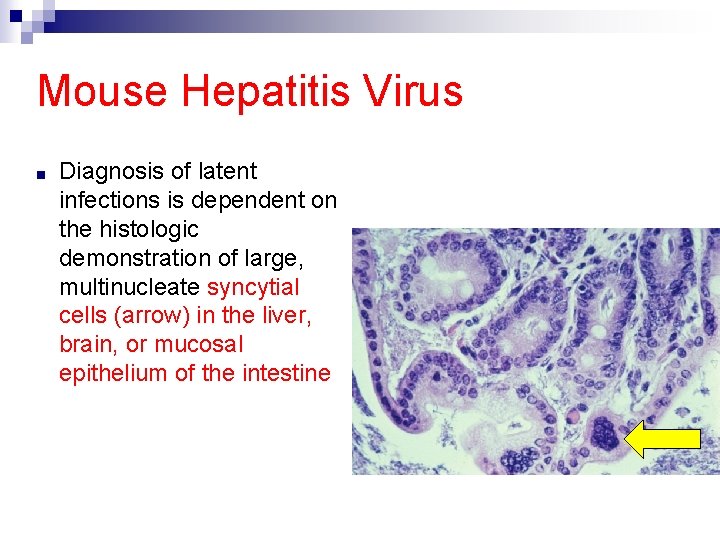 Mouse Hepatitis Virus ■ Diagnosis of latent infections is dependent on the histologic demonstration