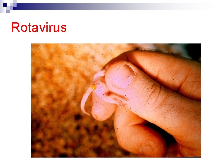 Rotavirus 