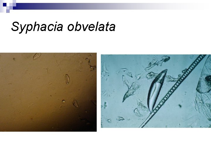 Syphacia obvelata 