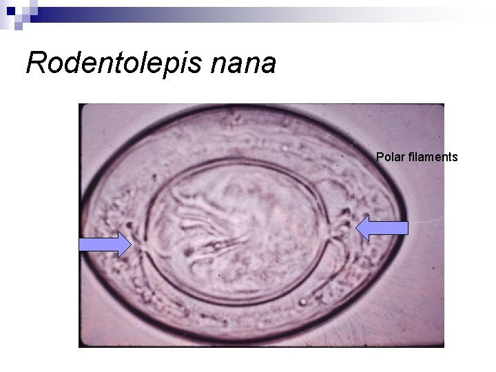 Rodentolepis nana Polar filaments 