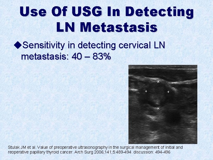 Use Of USG In Detecting LN Metastasis u. Sensitivity in detecting cervical LN metastasis: