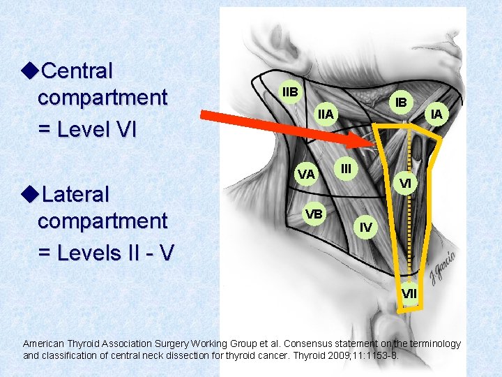 u. Central compartment = Level VI u. Lateral compartment = Levels II - V