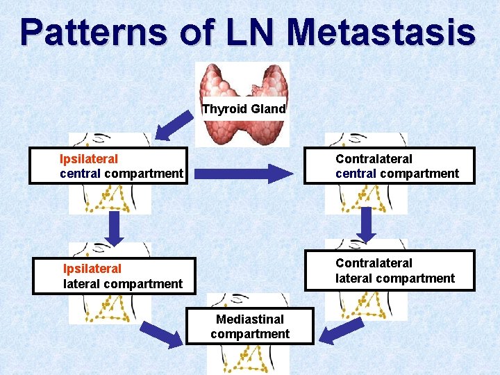 Patterns of LN Metastasis Thyroid Gland Ipsilateral central compartment Contralateral central compartment Ipsilateral compartment