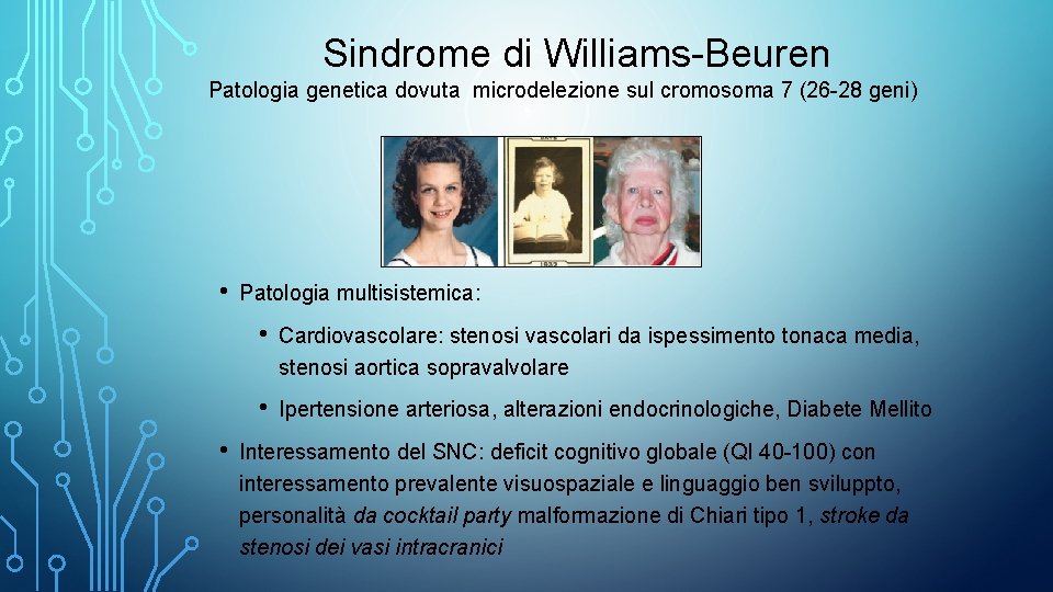 Sindrome di Williams-Beuren Patologia genetica dovuta microdelezione sul cromosoma 7 (26 -28 geni) •