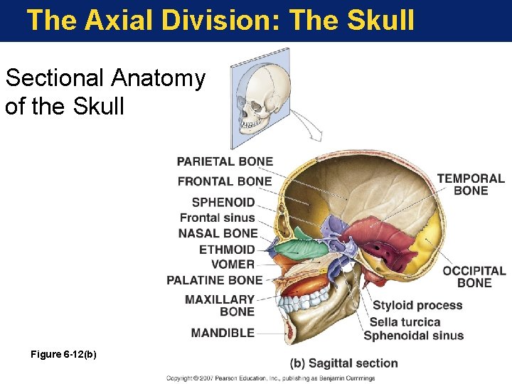 The Axial Division: The Skull Sectional Anatomy of the Skull Figure 6 -12(b) 