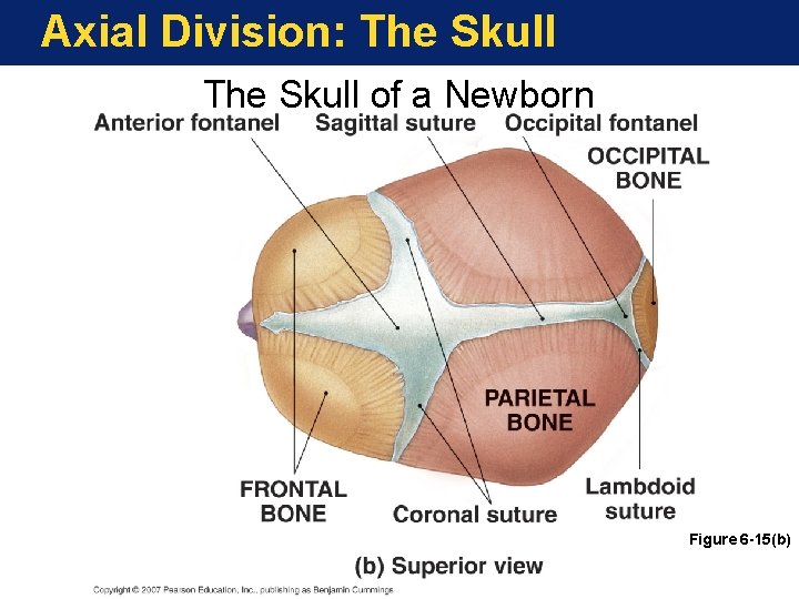 Axial Division: The Skull of a Newborn Figure 6 -15(b) 