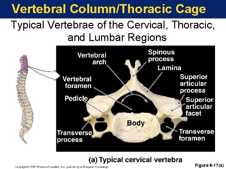 Vertebral Column/Thoracic Cage Typical Vertebrae of the Cervical, Thoracic, and Lumbar Regions Figure 6