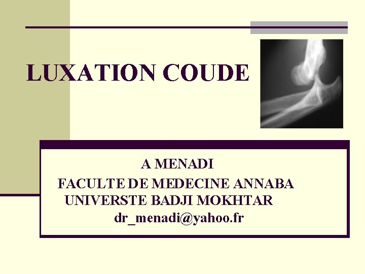 LUXATION COUDE A MENADI FACULTE DE MEDECINE ANNABA UNIVERSTE BADJI MOKHTAR dr_menadi@yahoo. fr 