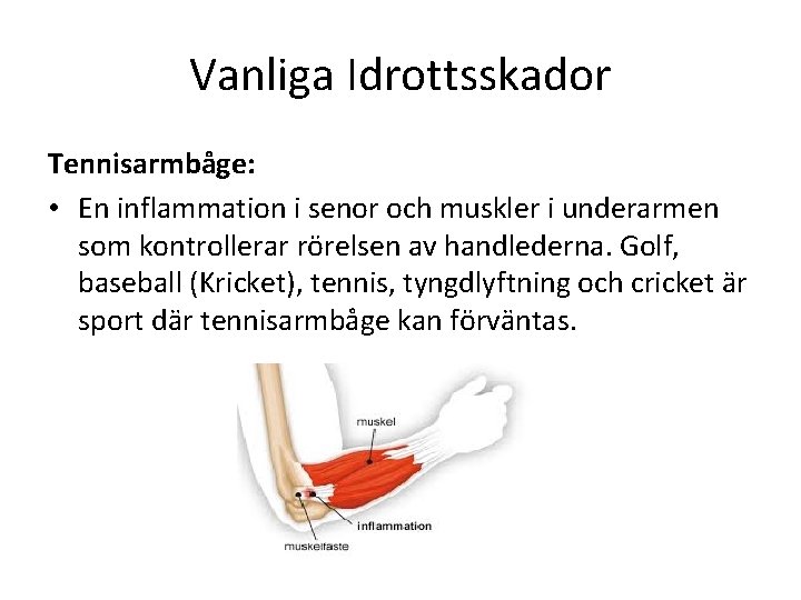 Vanliga Idrottsskador Tennisarmbåge: • En inflammation i senor och muskler i underarmen som kontrollerar