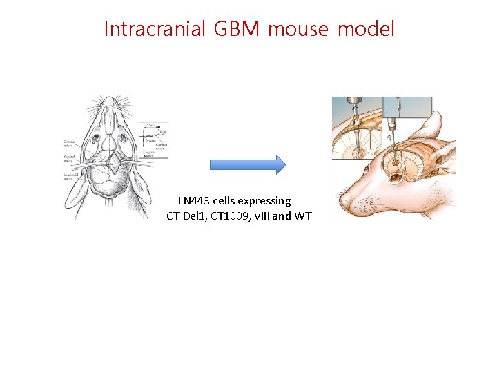 Intracranial GBM mouse model LN 443 cells expressing CT Del 1, CT 1009, v.