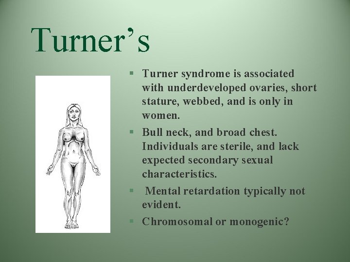 Turner’s § Turner syndrome is associated with underdeveloped ovaries, short stature, webbed, and is Turner’s § Turner syndrome is associated with underdeveloped ovaries, short stature, webbed, and is