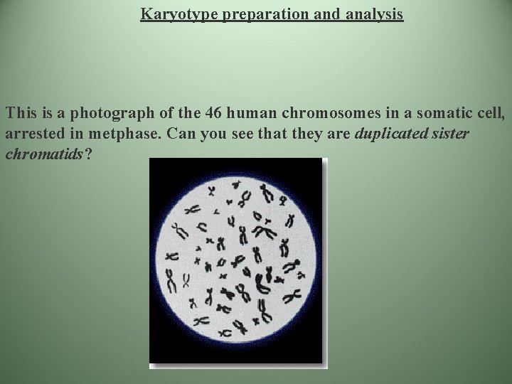 Karyotype preparation and analysis This is a photograph of the 46 human chromosomes in