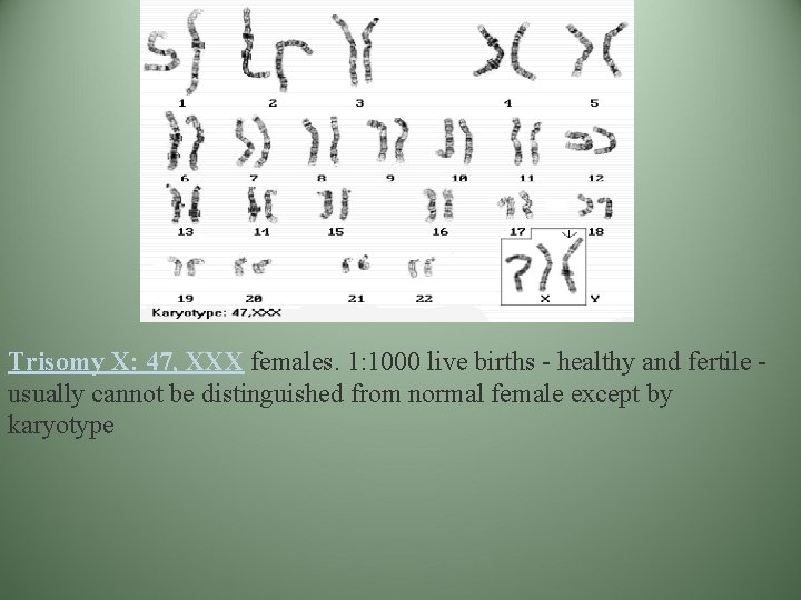 Trisomy X: 47, XXX females. 1: 1000 live births - healthy and fertile usually