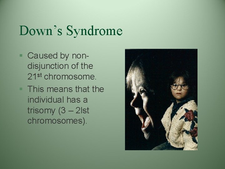 Down’s Syndrome § Caused by nondisjunction of the 21 st chromosome. § This means Down’s Syndrome § Caused by nondisjunction of the 21 st chromosome. § This means