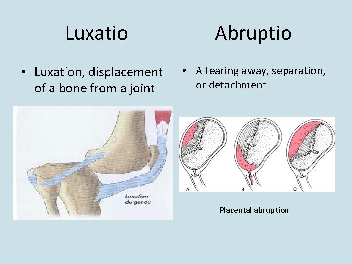 Luxatio • Luxation, displacement of a bone from a joint Abruptio • A tearing