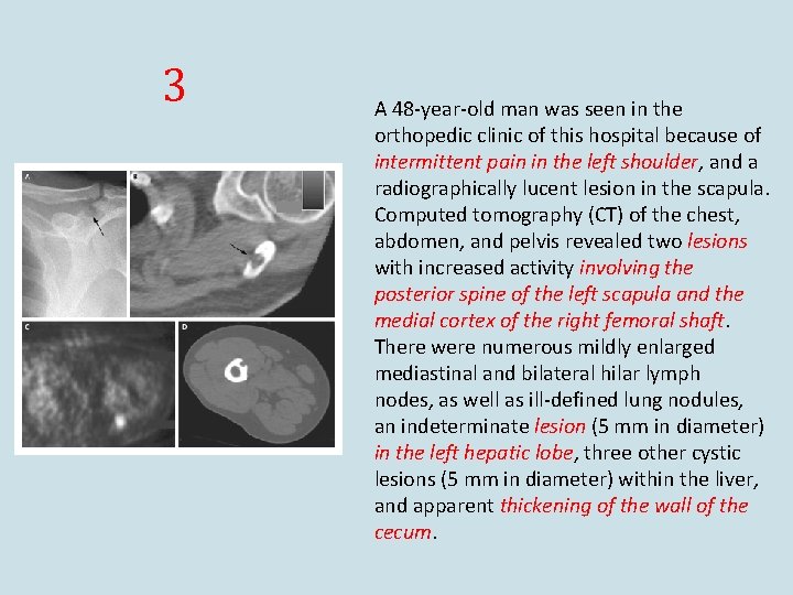 3 A 48 -year-old man was seen in the orthopedic clinic of this hospital