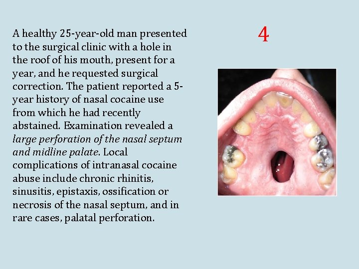 A healthy 25 -year-old man presented to the surgical clinic with a hole in