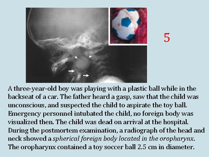 5 A three-year-old boy was playing with a plastic ball while in the backseat