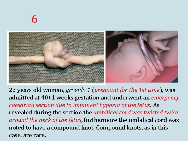 6 23 years old woman, gravida 1 (pregnant for the 1 st time), was