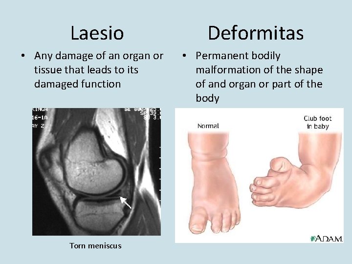 Laesio • Any damage of an organ or tissue that leads to its damaged