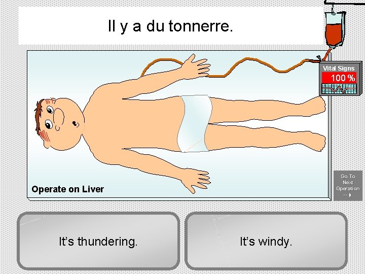 Il y a du tonnerre. Vital Signs 100 % Go To Next Operation --