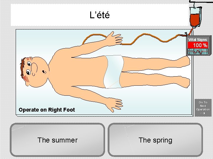 L’été Vital Signs 100 % Go To Next Operation -- -- Operate on Right