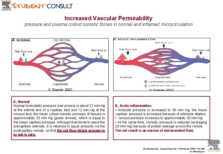 Increased Vascular Permeability pressure and plasma colloid osmotic forces in normal and inflamed microcirculation