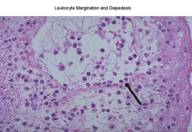 Leukocyte Margination and Diapedesis 