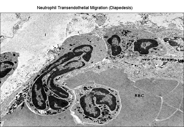 Neutrophil Transendothelial Migration (Diapedesis) 