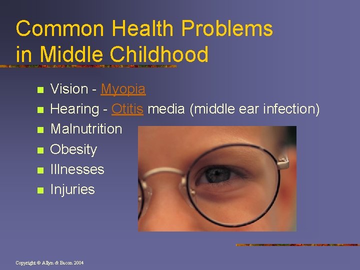 Common Health Problems in Middle Childhood n n n Vision - Myopia Hearing -